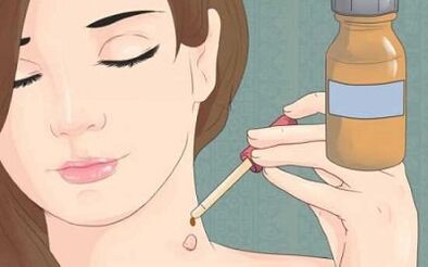 how to get rid of papillomas folk remedies