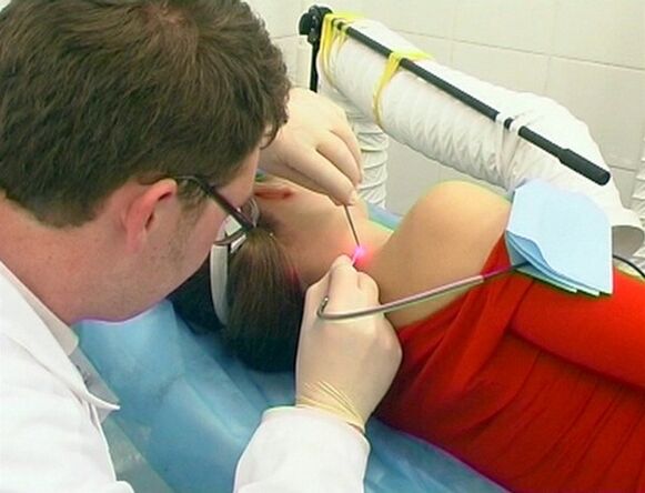 Removal of papilloma